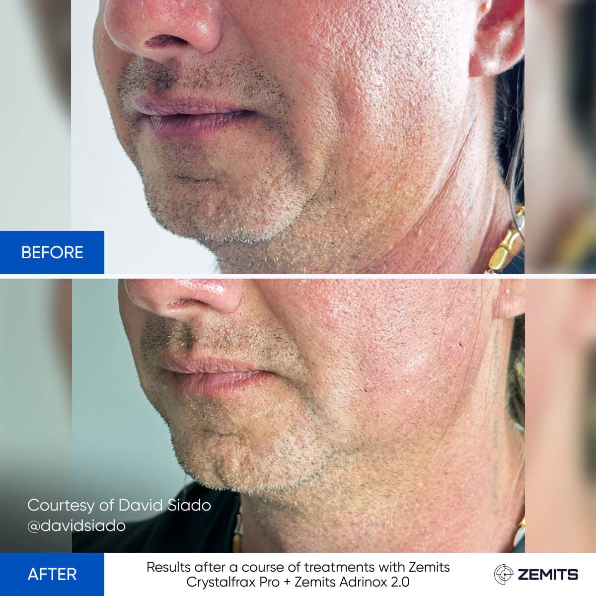 Before After Slide 6