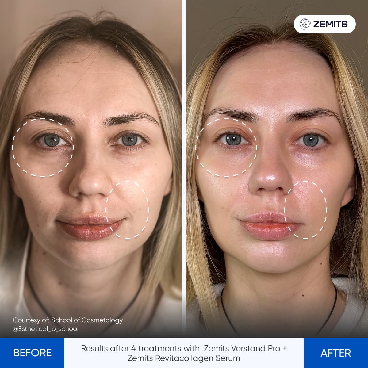 Before After Slide 9