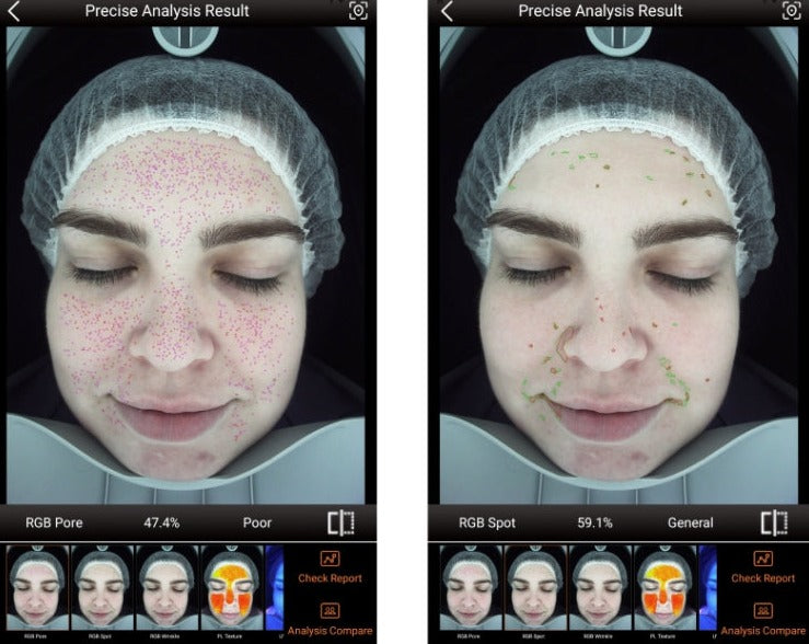 Zemits VeraFace جهاز تحليل البشرة